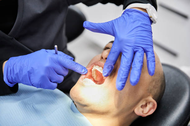 Best Emergency Wisdom Tooth Extraction in Gramercy, LA